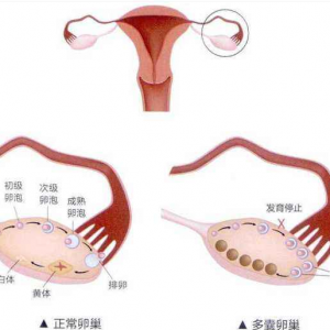 苏州正规试管婴儿助孕中介哪里最好
